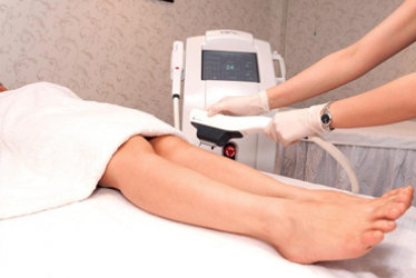 IPL – Triệt lông