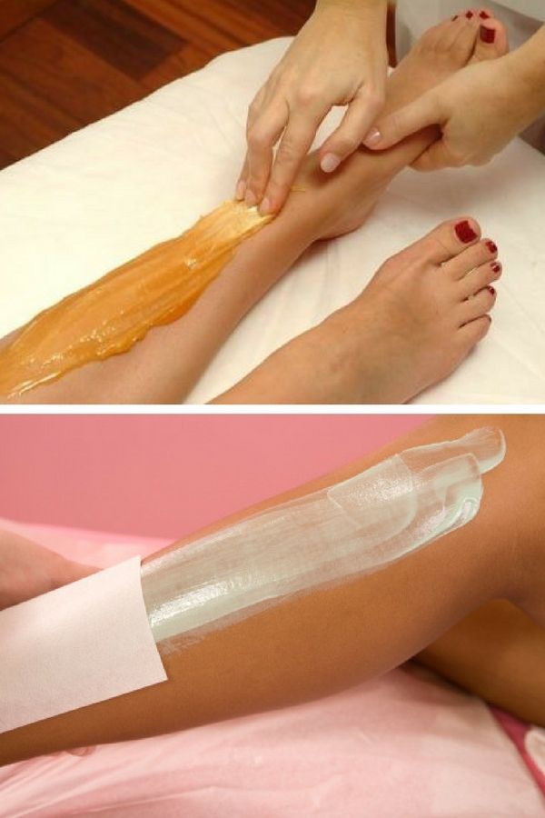 Loại bỏ những vùng lông không mong muốn bằng phương pháp Waxing