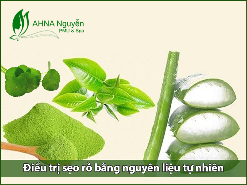 Điều trị sẹo rỗ bằng nguyên liệu tự nhiên